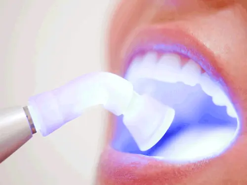 Soft-tissue laser dentistry available at Bluffdale Dental in Bluffdale, UT